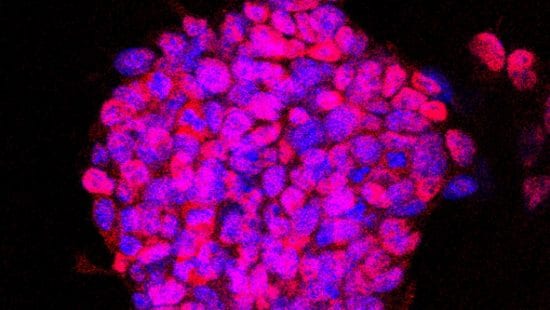 Project 4: Pluripotency